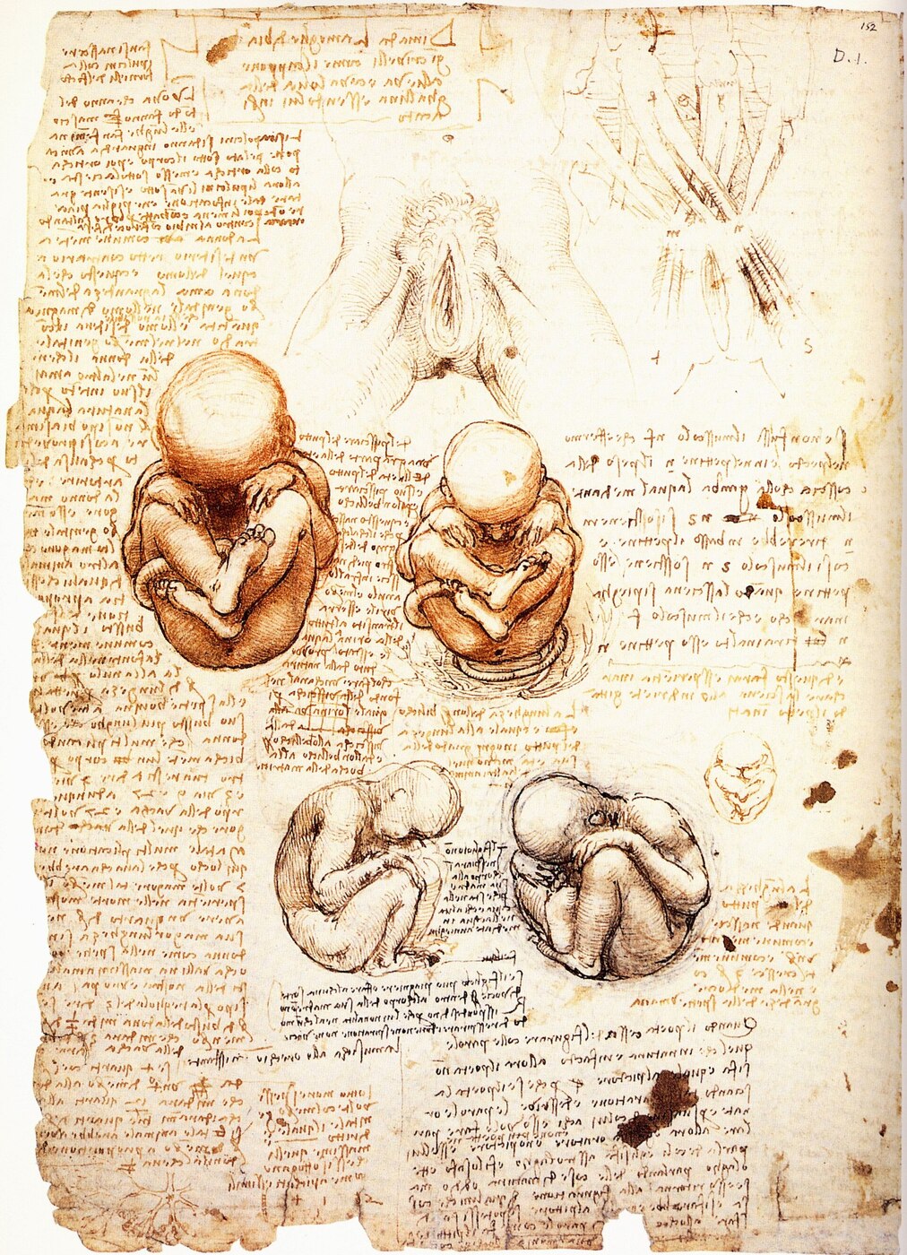Leonardo da Vinci, Studies of the Fetus in the Womb (c. 1510)