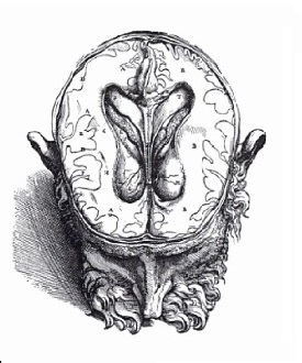 Andreas Vesalius, Plate 7 of Book VII from De Humani Corporis Fabrica showing dissected human musculature