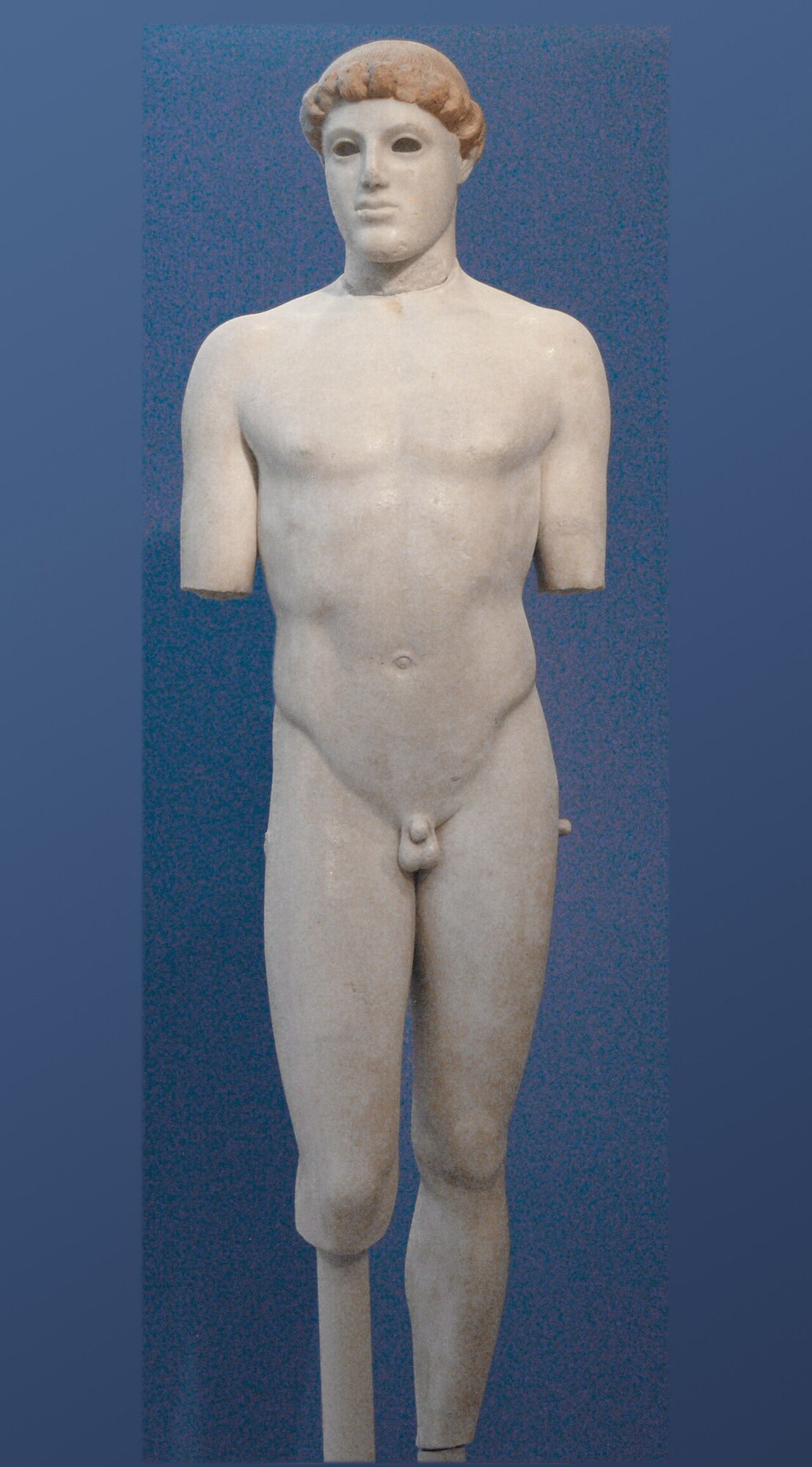 Kritios Boy, c. 480 BCE, Acropolis Museum, Athens \u2014 the first surviving example of contrapposto in Greek sculpture